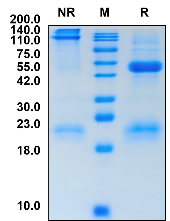 Recombinant Mouse FSH alpha & FSH beta Protein (hFc Tag)